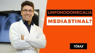 APRENDA A INTERPRETAR LINFONODOMEGALIAS MEDIASTINAIS [upl. by Asante]