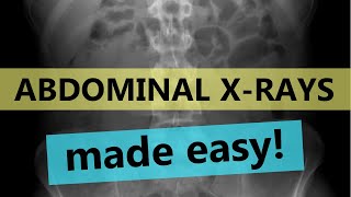 How to read abdominal xrays  EASY GUIDE [upl. by Schaefer958]