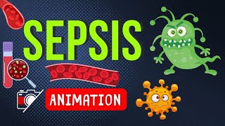 🦠 SEPSIS ANIMATION  🎬 FUNNY MEMORABLE MNEMONIC [upl. by Koh994]