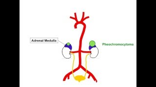 Pheochromocytoma and Paraganglioma Concept Video [upl. by Aihseket]