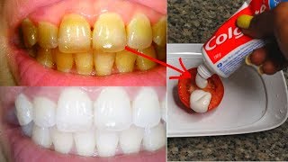 IN 2 MINUTES TURN YELLOW TEETH TO PEARLY WHITE WITH TOMATO [upl. by Amliw193]