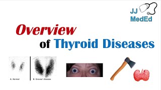 Overview of Thyroid Diseases Hashimoto’s Graves’ Sick Euthyroid Syndrome Toxic adenoma etc [upl. by Ob]