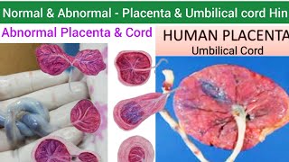 Human Placenta  Structure Function amp Abnormalities of Placenta amp Umbilical cord  Umbilical Cord [upl. by Bock]