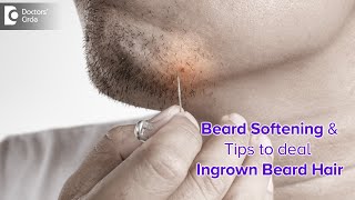 INGROWN BEARD HAIR  Ingrown facial hair in MEN Causes amp Treatment Dr Nischal K  Doctors Circle [upl. by Cronin]