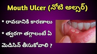 Mouth Ulcers Reasons and Treatment in Telugu [upl. by Naaman]