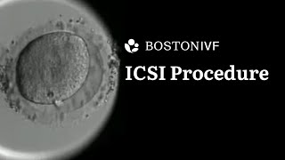 ICSI Procedure Explained  Science at Boston IVF [upl. by Airdnaxila714]