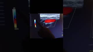 Optimizing Doppler Settings When Imaging [upl. by Lednahs]