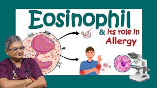 ইওসিনোফিল কি Why Eosinophils are SO Important for Your Body Role of eosinophils in allergy [upl. by Micheal424]