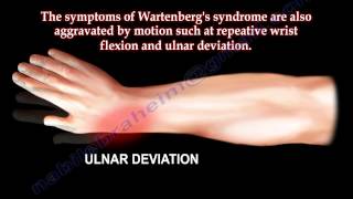 Entrapment of Radial Nerve Wartenbergs Syndrome  Everything You Need To Know  Dr Nabil Ebraheim [upl. by Ganiats]