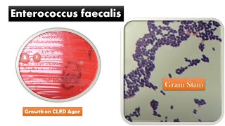 Enterococcus faecalis Colony Morphology and Gram Staining [upl. by Ynneh480]