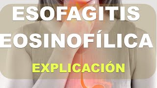 Qué es la esofagitis eosinofilica [upl. by Htiaf]