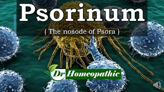 Psorinum  Homeopathic Medicine [upl. by Aliab]