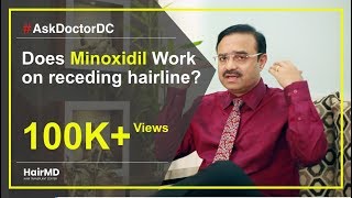 Does Minoxidil Work On Receding Hairline  HairMD Pune  In HINDI [upl. by Dnaleel]