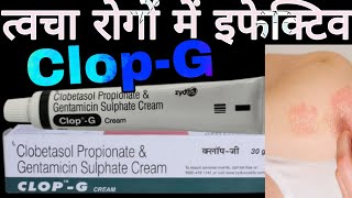 CLOPG Cream Uses in Hindi  Clobetasol Propionate amp Gentamicin Sulphate Cream [upl. by Bald899]