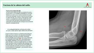 64 Conceptos prácticos del codo y antebrazo Clase de Anatomía Humana de Gray [upl. by Justin36]