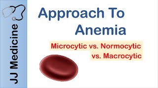 Anemia  Microcytic vs Normocytic vs Macrocytic [upl. by Dnomaid]