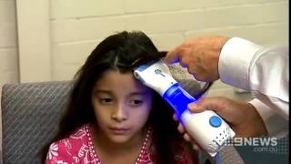 One Step Solution for Head lice and eggs [upl. by Nauqad]