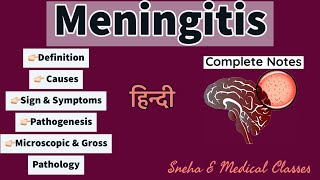 Meningitis Pathology  Hindi  Gross amp Microscopic Pathology  Pathogenesis  Hindi [upl. by Mccall]