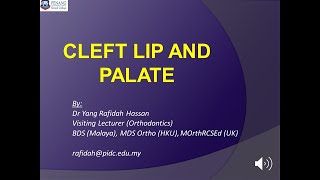 Cleft Lip and Palate [upl. by Salocin153]