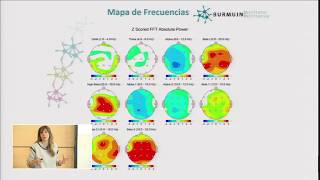 QEEG Electroencefalograma cuantitativo [upl. by Firooc412]