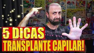 5 dica para seu Transplante Capilar  IMPLANTE CAPILAR [upl. by Ylera]