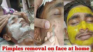 Pimples removal on face at home Pimples thik karne ka sahi tarika [upl. by Sonahpets]