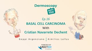 Ep16 BASAL CELL CARCINOMA with Cristian Navarrete Dechent  Dermoscopy Happy Hour [upl. by Anehs819]