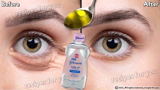 In 3 days Remove Under Eye Bags Completely  Remove Dark Circles Wrinkles and Puffy Eyes [upl. by Ise]