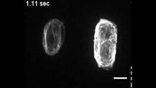 Cardiomyocytes beat together [upl. by Zolnay]