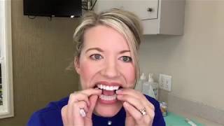 Teeth Whitening Instructions [upl. by Haliek]