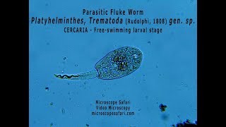 Parasitic fluke worm  Trematode cercaria larva [upl. by Tybalt155]