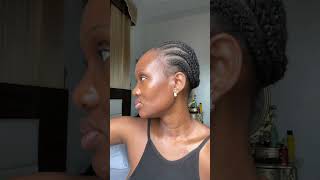 How I treat my hyperpigmentation Uneven skin tone Textured skin The Ordinary glycolic acid short [upl. by Ahsirtap]