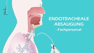 Endotracheale Absaugung für Pflegepersonal  Animation  Fahl MedizintechnikVertrieb GmbH [upl. by Ahsinirt958]