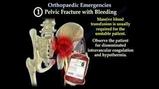 Orthopaedic Emergencies Part 1  Everything You Need To Know  Dr Nabil Ebraheim [upl. by Goth]