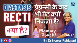 प्रेग्नन्सी के बाद भी पेट निकला हुआ What is Diastasis Recti Part 1  Dr Neeraj Pahlajani [upl. by Aicinat427]