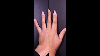 Hand Rejuvenation with Dr Sheila Nazarian [upl. by Sylram]