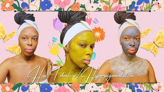 How I deal w hyperpigmentation  TSW [upl. by Geri]