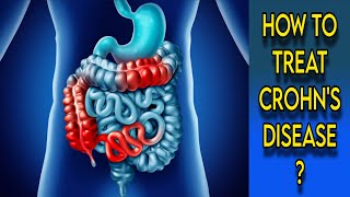 Crohns Disease Treatment  Crohns Disease Symptoms and Signs  Crohns Disease Diet [upl. by Dnomso]