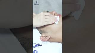 Acne treatment for mens skin [upl. by Arramahs]