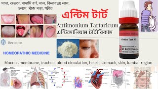 08 Antimonium Tartaricum l এন্টিম টার্ট l মেটেরিয়া মেডিকা l Materia Medical Learn Antim Tart easily [upl. by Robillard64]