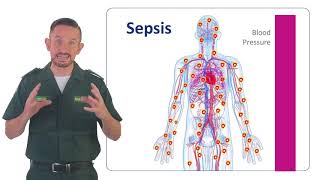 Understanding Sepsis Elearning Course Preview [upl. by Zurciram]