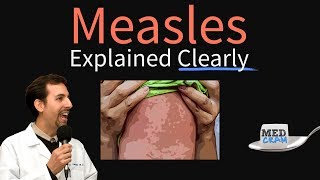 Measles rubeola Explained Clearly by MedCramcom [upl. by Laeynad]