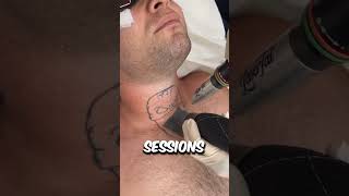 How Exactly Does Laser Tattoo Removal Actually Work 😳 [upl. by Leitnahs]