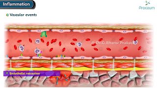 2 Acute Inflammation Vascular Events Animation [upl. by Charley]