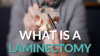 What is a Laminectomy  Spine Surgery Basics [upl. by Prochora]