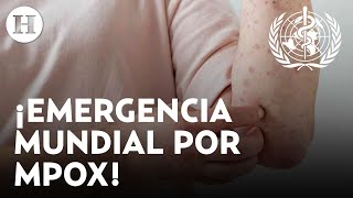 ¿Nueva pandemia se avecina OMS evalúa declarar el virus mpox como emergencia sanitaria mundial [upl. by Jonell]