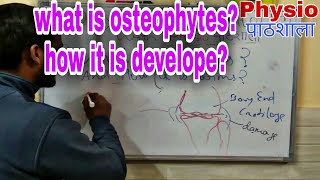 Osteophytes how it is develope [upl. by Faunia580]