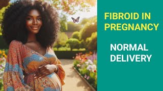 Fibroid in pregnancy  Normal delivery or CS  My pregnancy Journey [upl. by Azar]