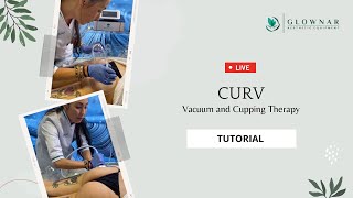 Curv Vacuum and Cupping Therapy Live Demo [upl. by Ahseek]