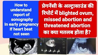 blighted ovum Incomplete or missed abortion का ultrasound रिपोर्ट मे क्या मतलब होता है [upl. by Cudlip846]